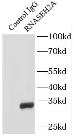 RAB11-Specific antibody|RAB11抗