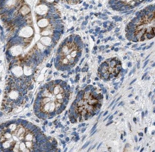 TUBGCP4 antibody|TUBGCP4抗体