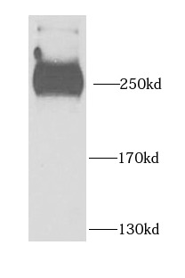 PHIP antibody|PHIP抗体