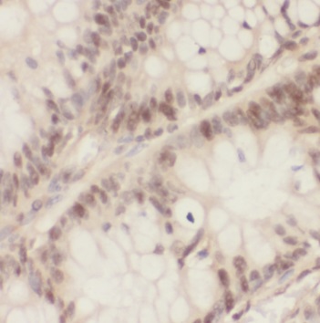 PSMA1 antibody|PSMA1抗体