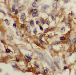 Bcl-XL antibody|Bcl-XL抗体