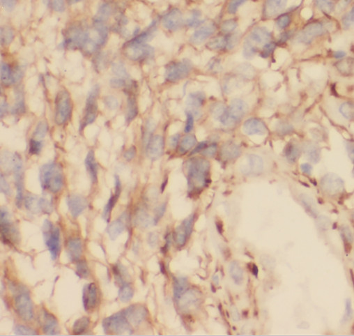 RAB5A-Specific antibody|RAB5A抗