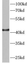 GOT1 antibody|GOT1抗体 FNab09876