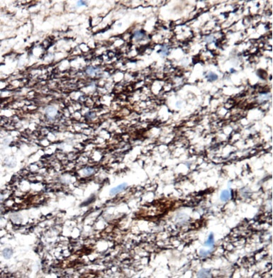 NEFL antibody|NEFL抗体 FNab05710