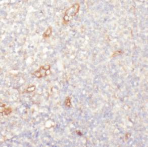 PECAM1 antibody|PECAM1抗体 FNab0