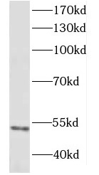 DCTN2 antibody|DCTN2抗体 FNab025