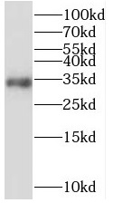 STARD7 antibody|STARD7抗体