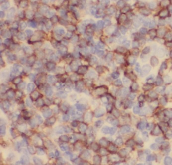 CD23 antibody|CD23抗体 FNab01446