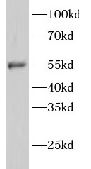 GATA1 antibody|GATA1抗体 FNab033