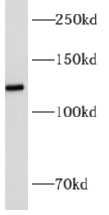 AMOT antibody|AMOT抗体 FNab00366