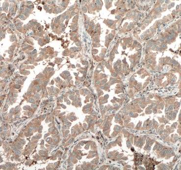TPSD1 antibody|TPSD1抗体