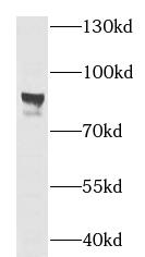 SLC20A1 antibody|SLC20A1抗体