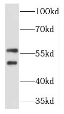 TCP11 antibody|TCP11抗体