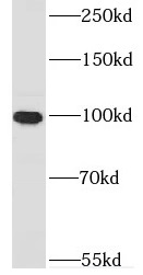 DNM3 antibody|DNM3抗体