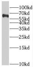 SLC37A2 antibody|SLC37A2抗体