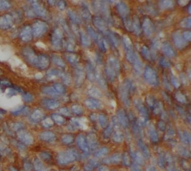 CYP2E1-Specific antibody|CYP2E