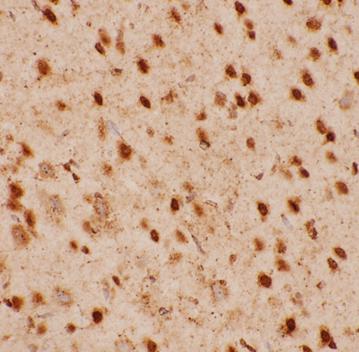 Histamine antibody|Histamine抗体