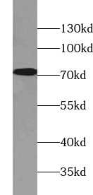 TSPAN33 antibody|TSPAN33抗体