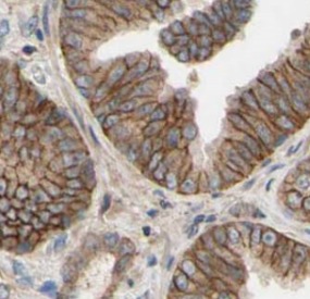 POTED-Specific antibody|POTED抗