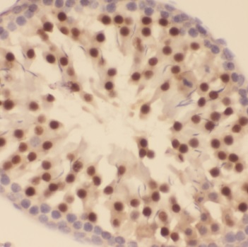 TEX13A antibody|TEX13A抗体