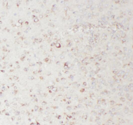 TAC1 antibody|TAC1抗体