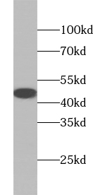 AARSD1 antibody|AARSD1抗体