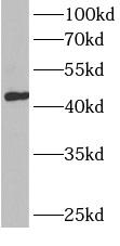 BCAT1 antibody|BCAT1抗体