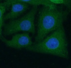 BAIAP3 antibody|BAIAP3抗体