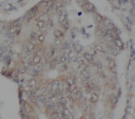 TAB2 antibody|TAB2抗体 FNab09979