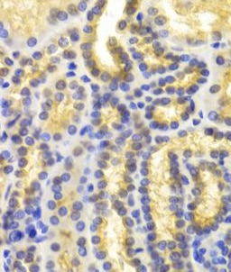 EIF5A antibody|EIF5A抗体 FNab027