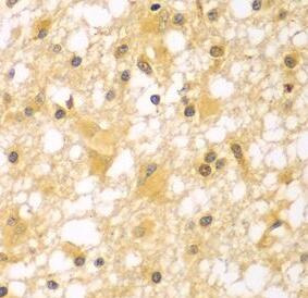 PAK6 antibody|PAK6抗体