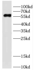 DDB2 antibody|DDB2抗体