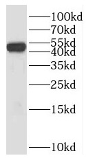 SH2D2A antibody|SH2D2A抗体