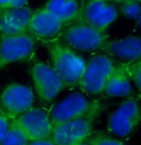 AMOT antibody|AMOT抗体 FNab09852