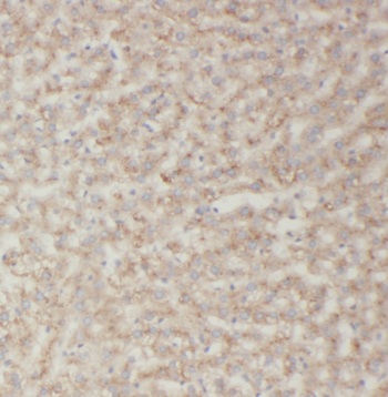 TRIM14 antibody|TRIM14抗体