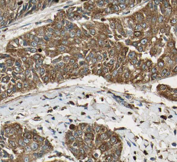 ATF6 antibody|ATF6抗体 FNab00664