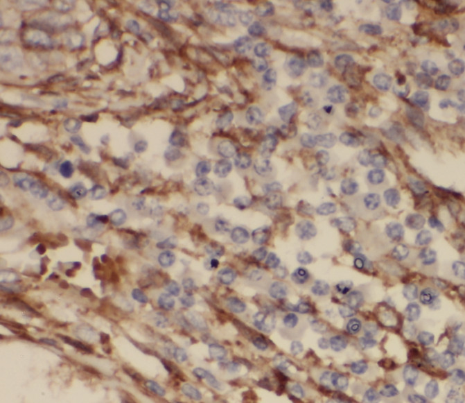 RRAS2 antibody|RRAS2抗体
