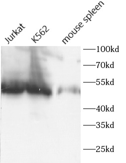 CD1D antibody|CD1D抗体 FNab10438