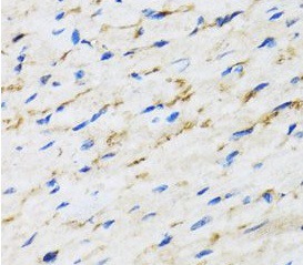 RAF1 antibody|RAF1抗体 FNab07087