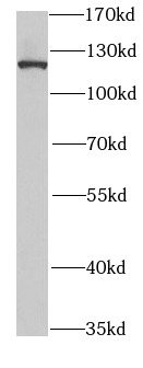 SND1 antibody|SND1抗体 FNab08063
