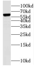 GNL3 antibody|GNL3抗体