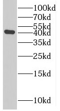 RRP7A antibody|RRP7A抗体