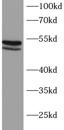 MAP2K7 antibody|MAP2K7抗体 FNab1