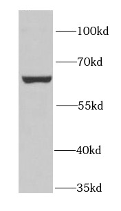 PUF60 antibody|PUF60抗体