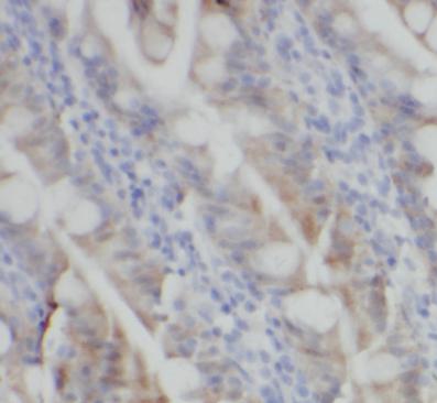 SNX17 antibody|SNX17抗体