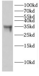 EHF antibody|EHF抗体