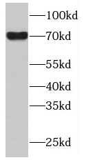 MAPK7 antibody|MAPK7抗体 FNab049