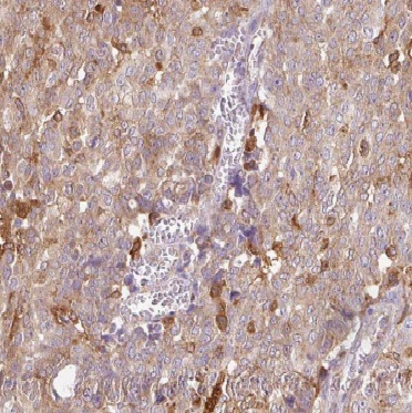 CYTH2 antibody|CYTH2抗体