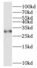 ORAI3 antibody|ORAI3抗体