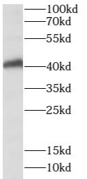 SPATA22 antibody|SPATA22抗体
